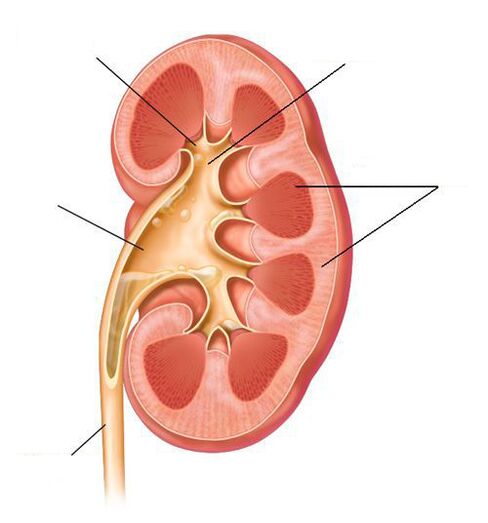 akutni pielonefritis kot zaplet cistitisa